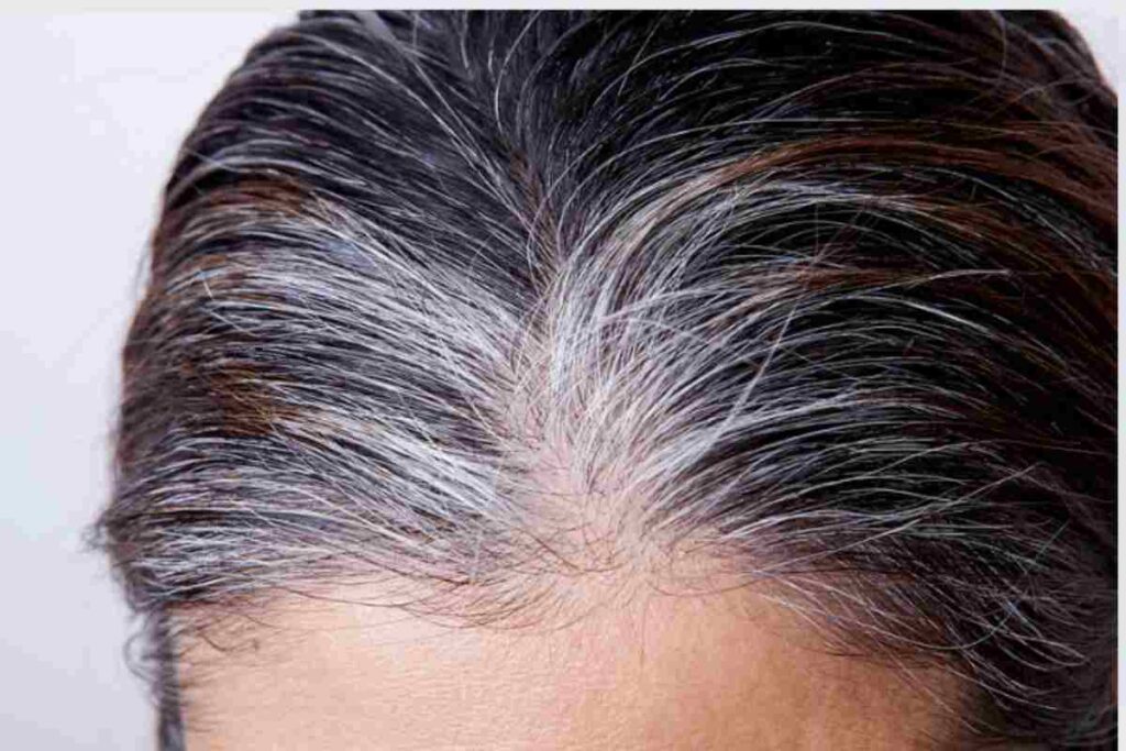 Ricrescita capelli grigi